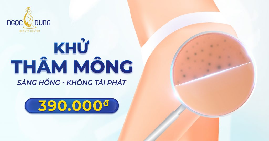 XÓA SẠCH THÂM MÔNG – TỰ TIN QUYẾN RŨ 16 thammong 390k ngang