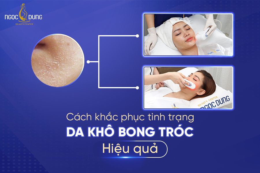da khô bong tróc