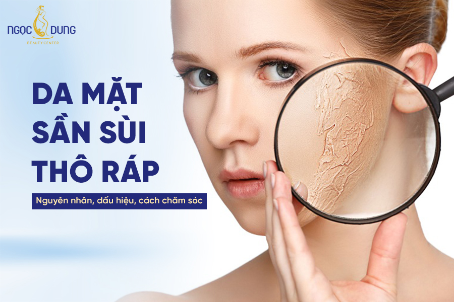 da mặt sần sùi