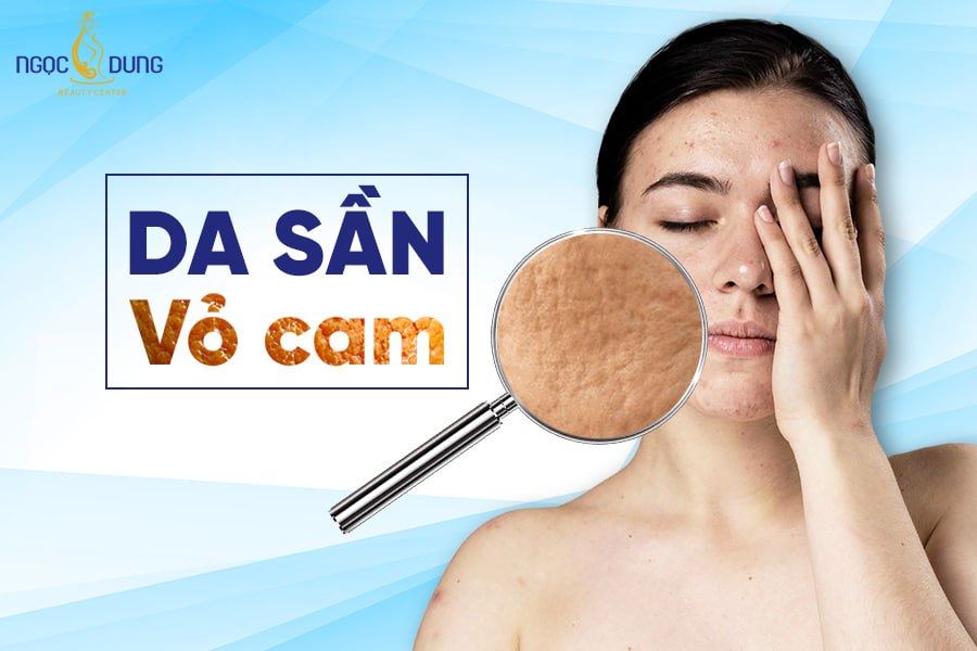 da sần vỏ cam