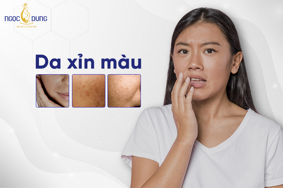 da xỉn màu