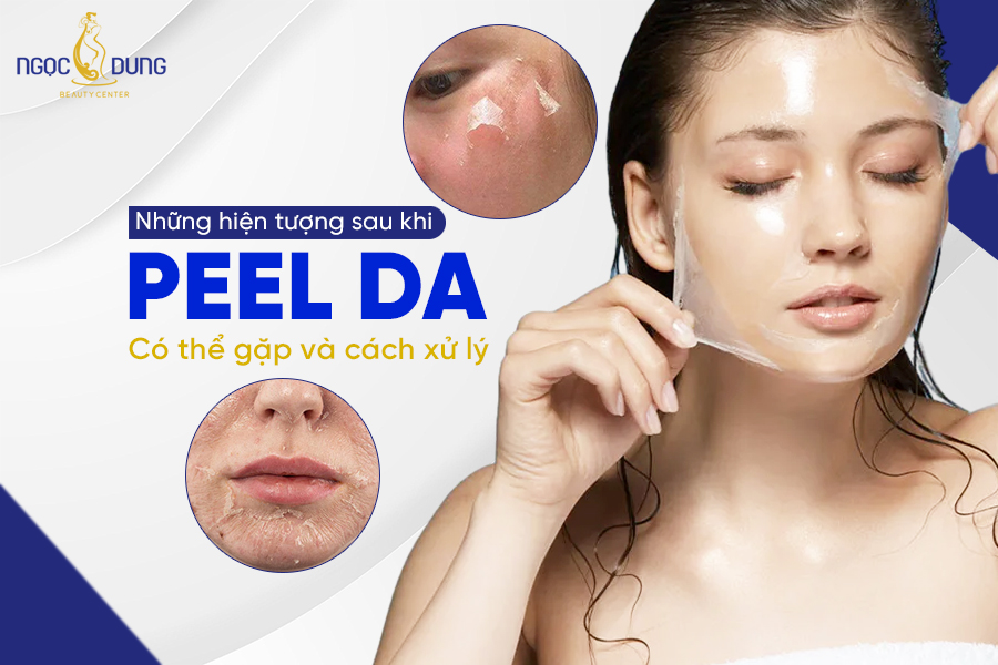 hiện tượng sau khi peel da