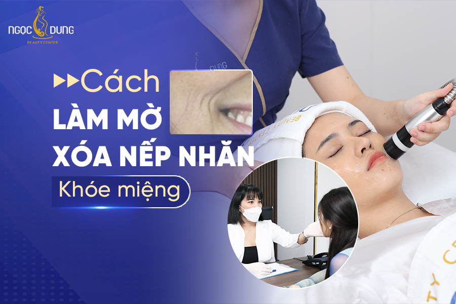 xóa nếp nhăn khóe miệng