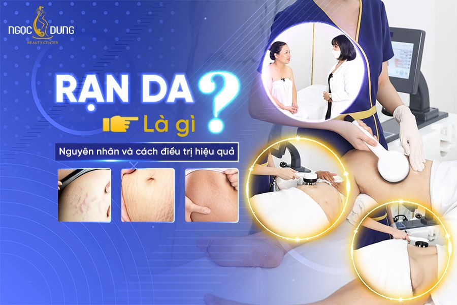 rạn da