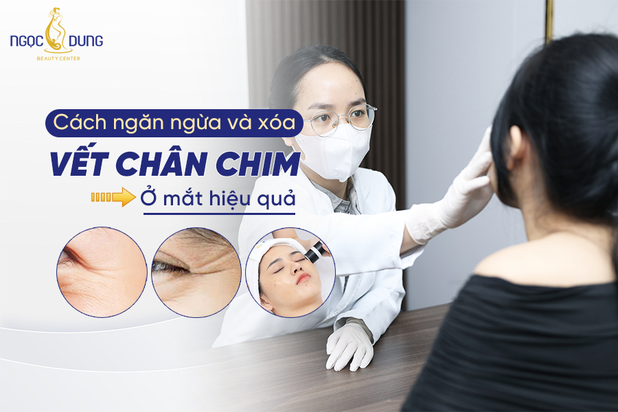 vết chân chim