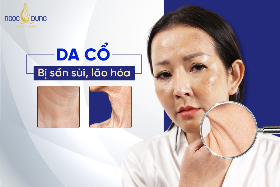 da cổ bị sần