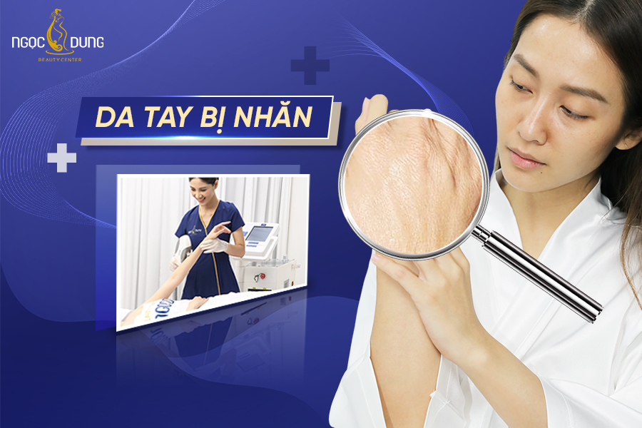 da tay bị nhăn