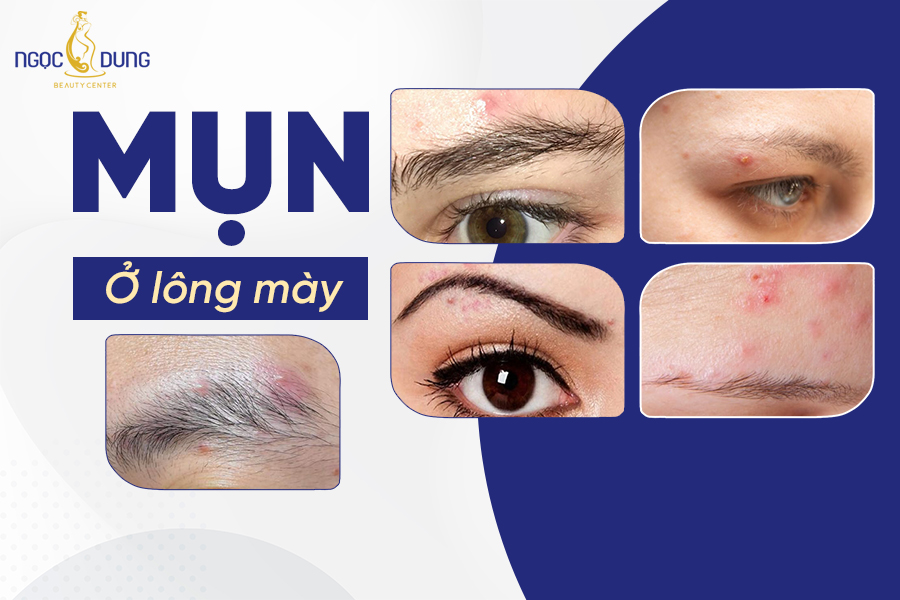 mun o long may
