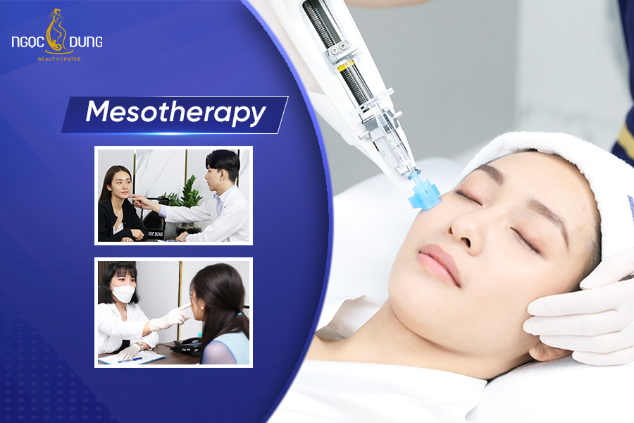 Liệu pháp Mesotherapy là gì? Ưu nhược điểm của tiêm Meso