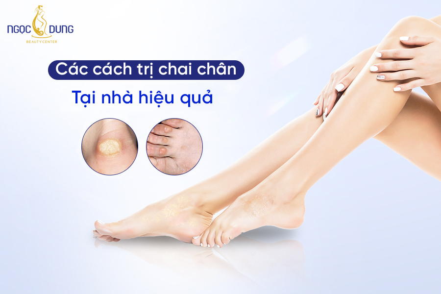 chai chân