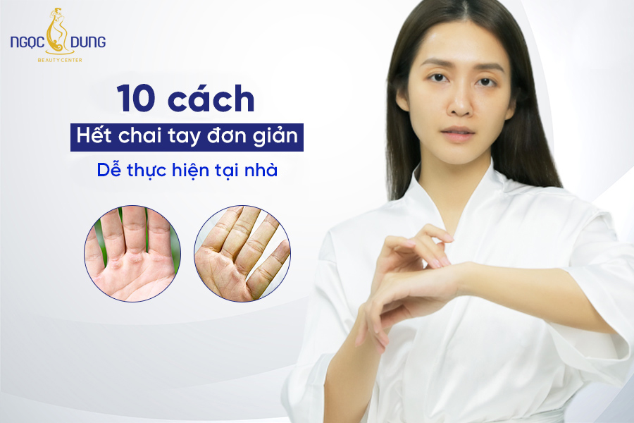 chai tay