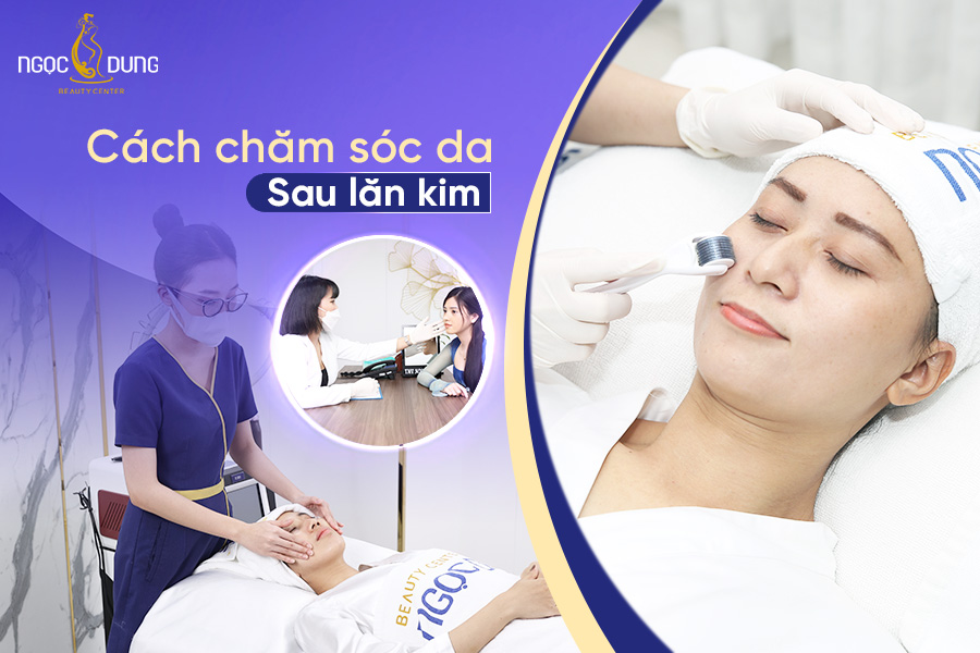 cham soc da sau lan kim
