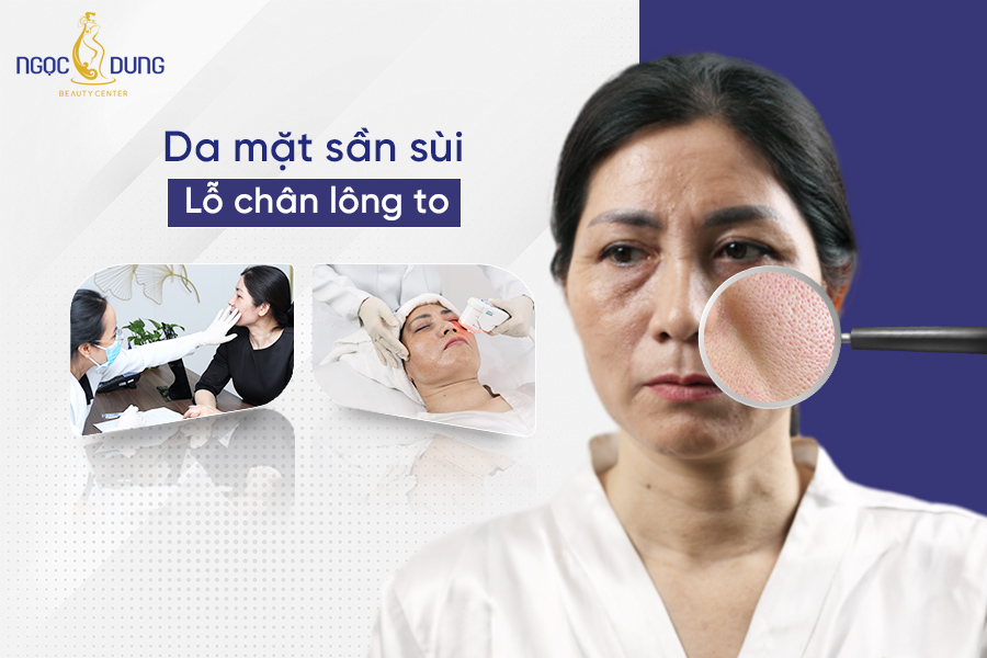 da mặt sần sùi lỗ chân lông to