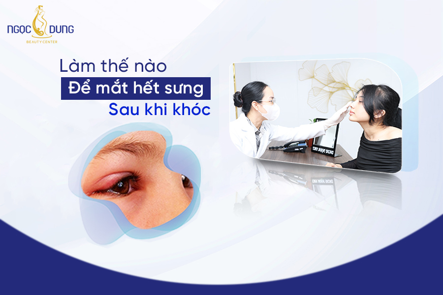 làm thế nào để mắt hết xưng sau khi khóc