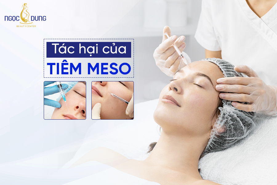 Lợi ích và tác hại của tiêm Meso trong làm đẹp bạn nên biết